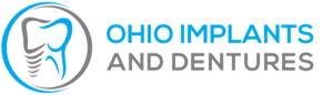 Ohio Implants and Dentures